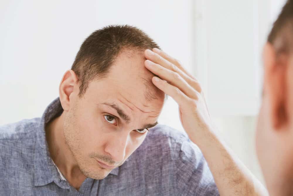 A: Worried man checking thinning hair and how hormones contribute to hair loss issues