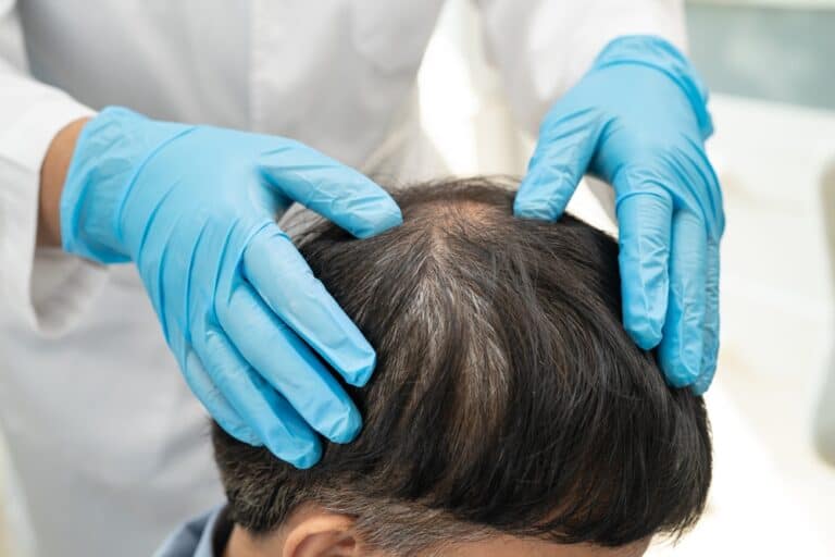 Doctor examining a male patient to assess the stress and hormones causes of hair loss