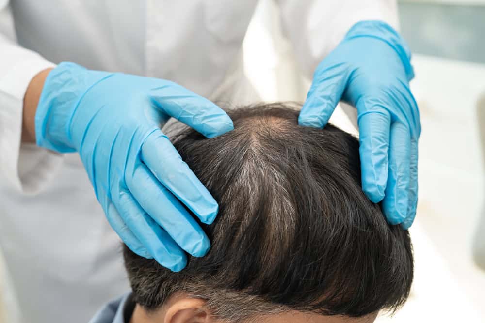Doctor examining a male patient to assess the stress and hormones causes of hair loss