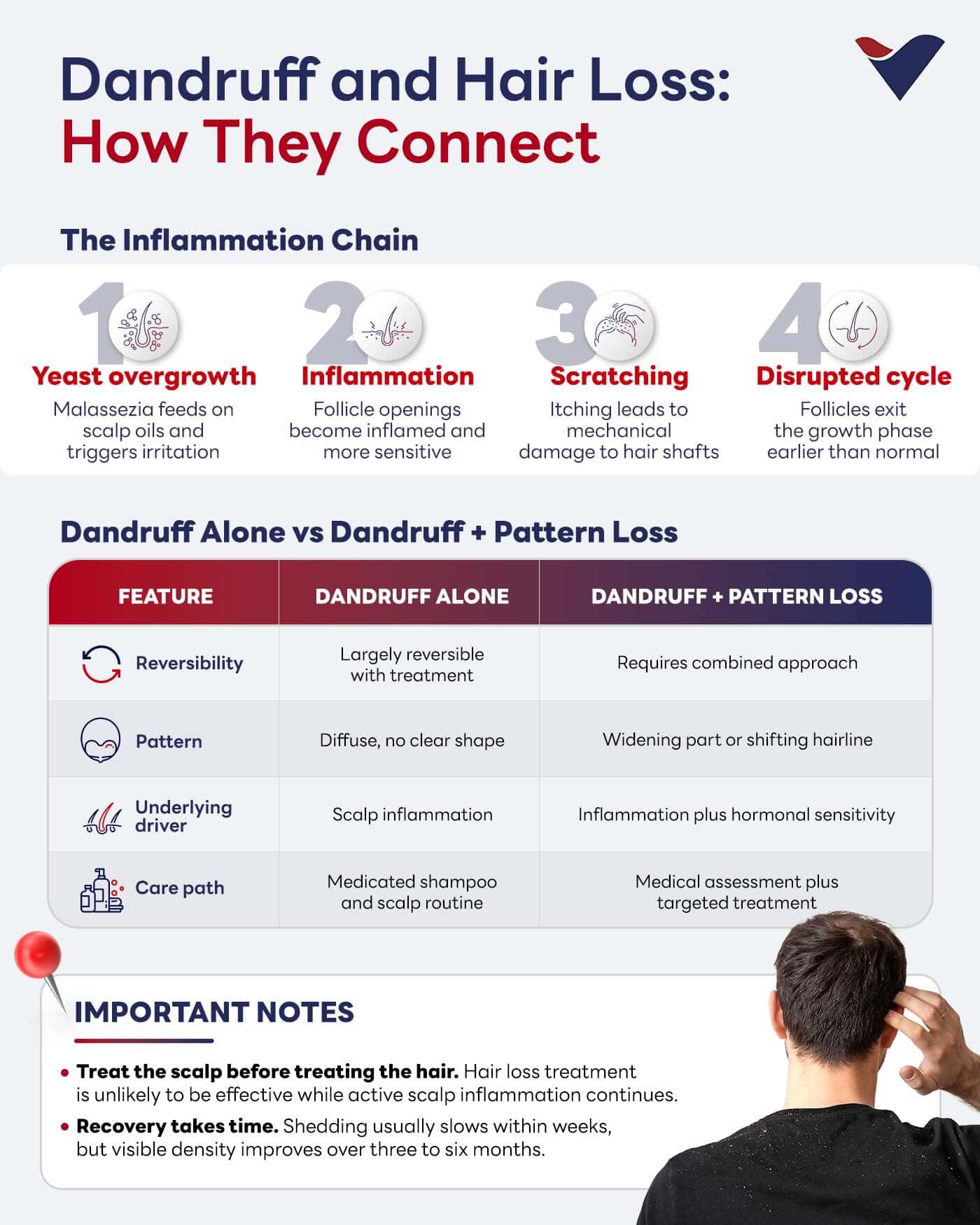 Infographic showing how dandruff and hair loss are connected through inflammation