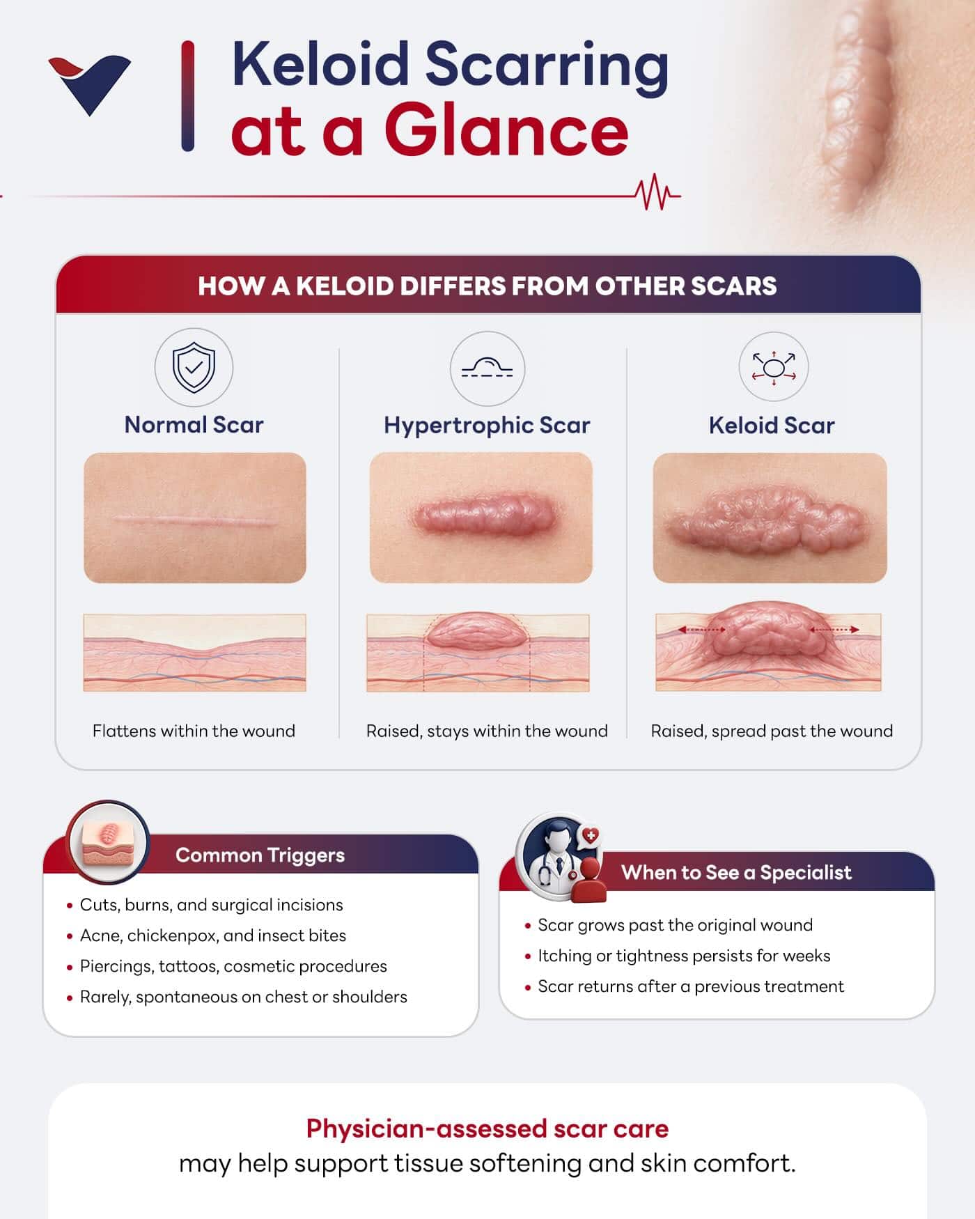 Visual breakdown of keloid scarring showing how it differs from other scars, common triggers, and when to see a specialist.