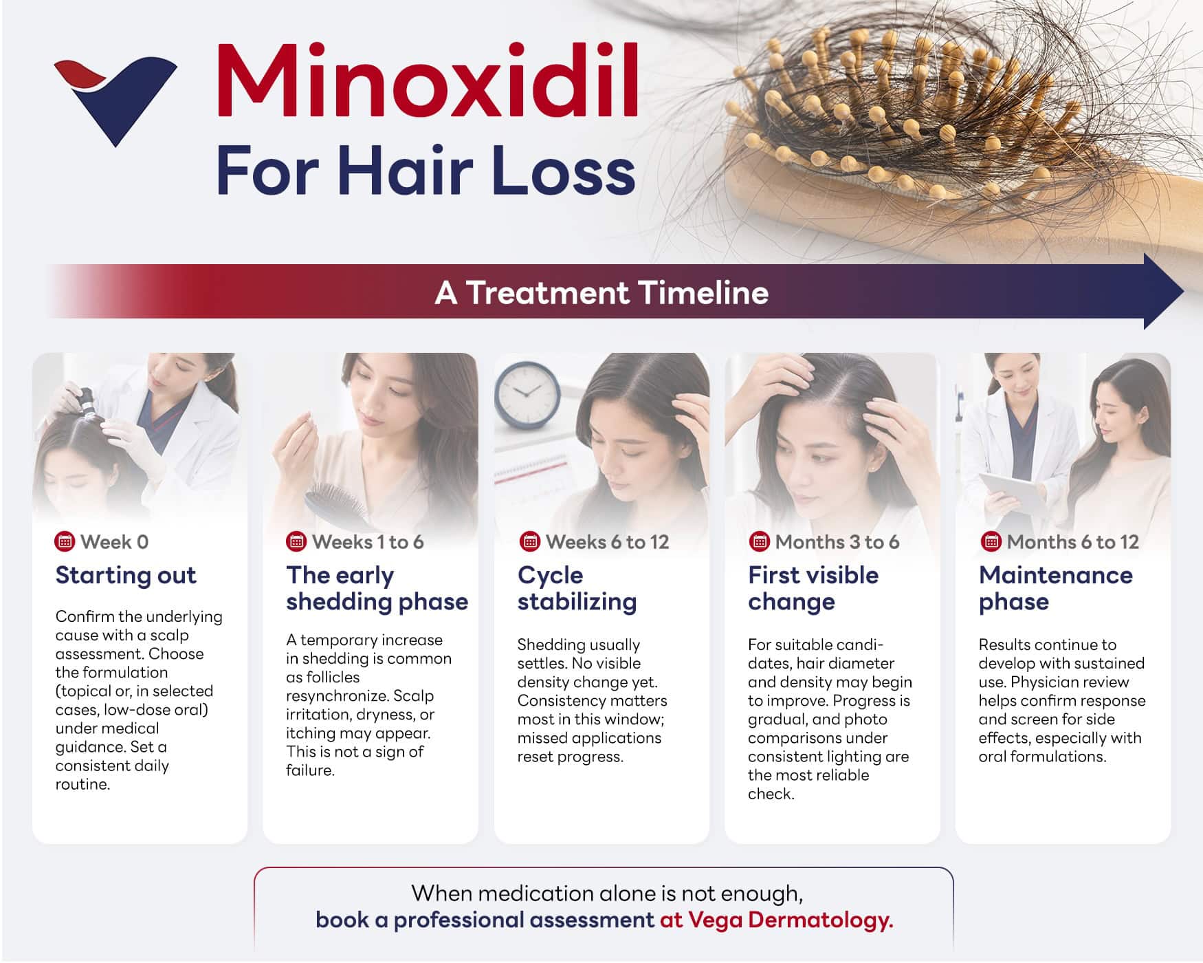 Minoxidil Treatment Timeline.