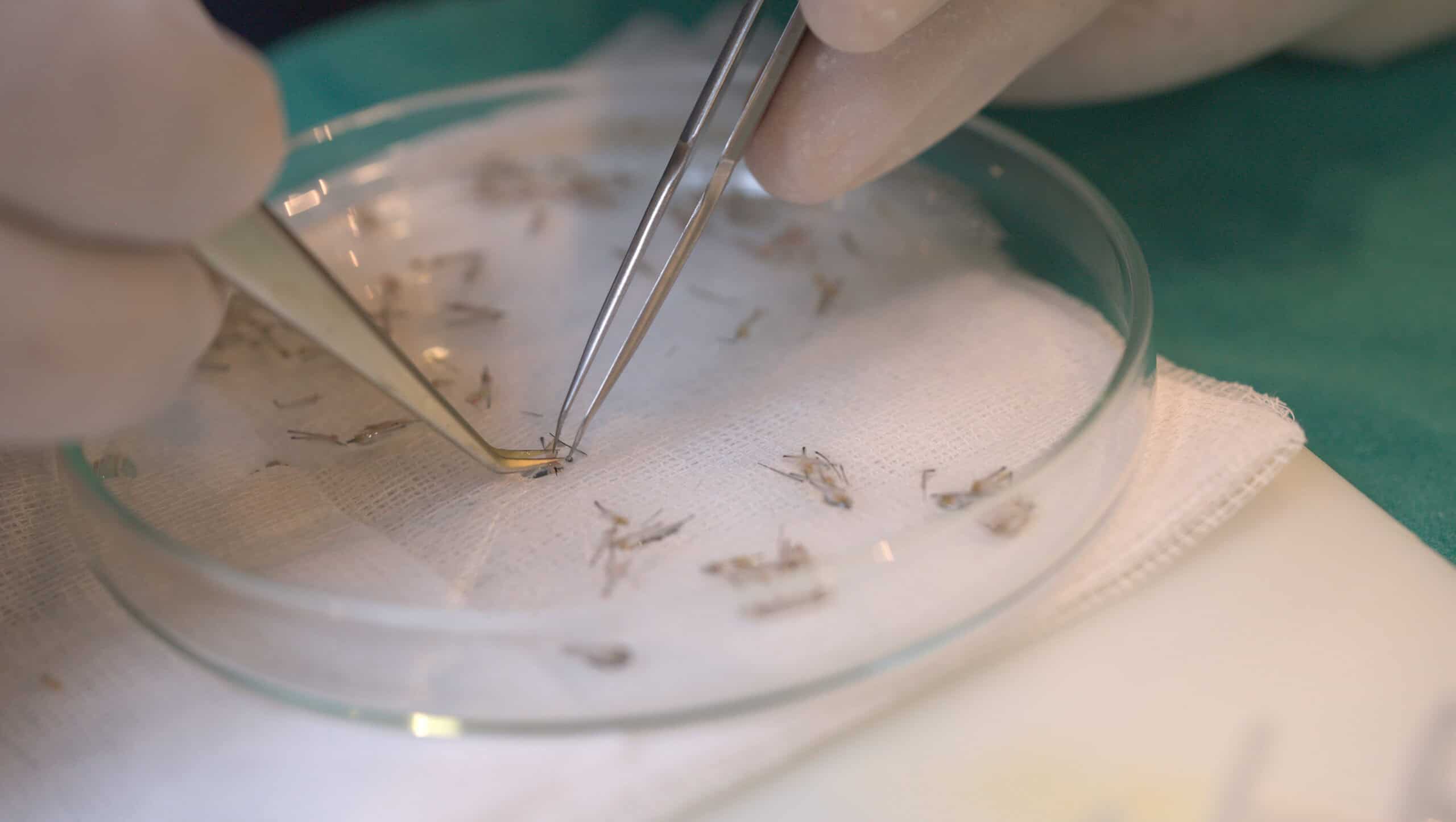 A doctor collecting hair follicles for hair follicle regeneration stem cell therapy