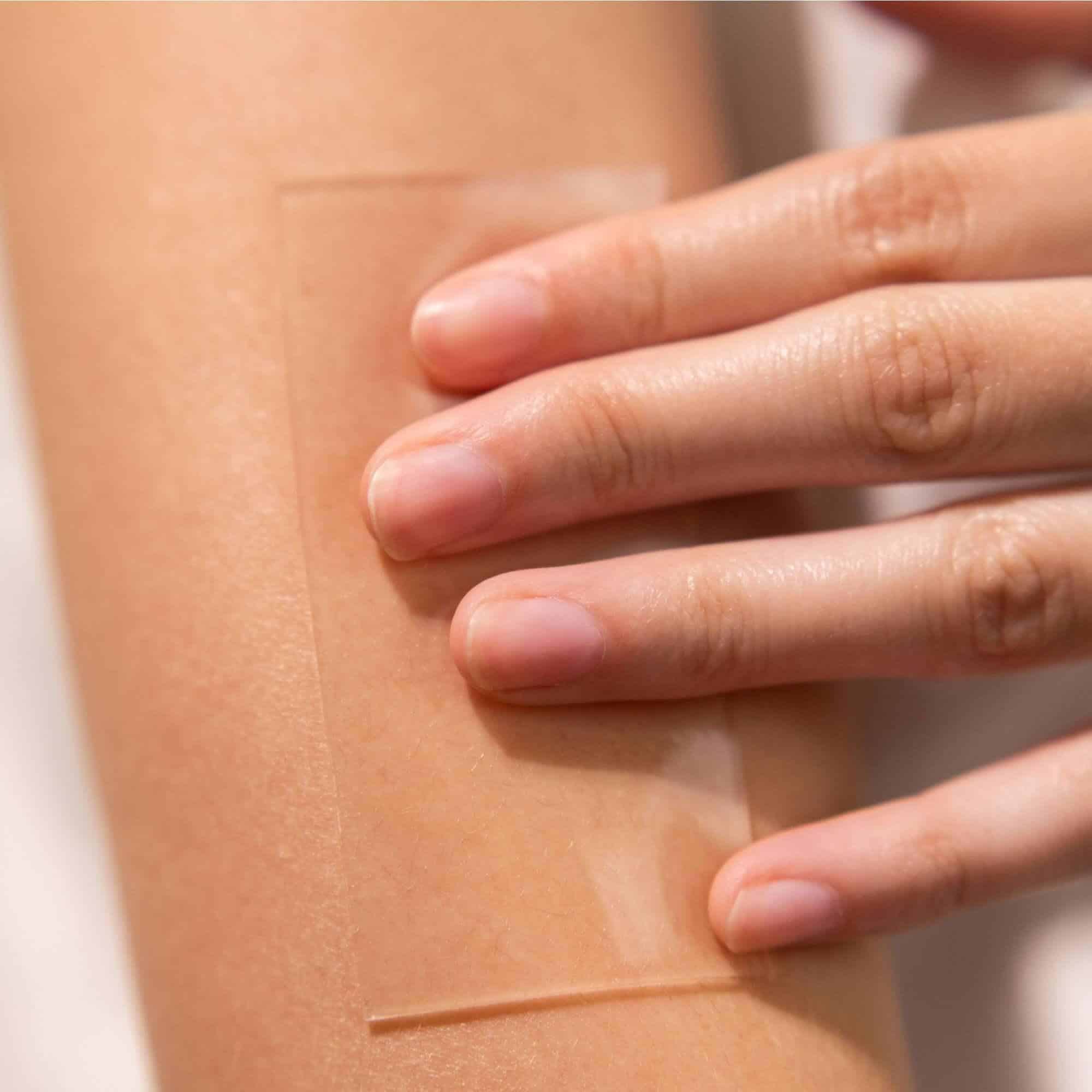 Scar tissue treatment with a medical grade healing tape on a patient’s arm