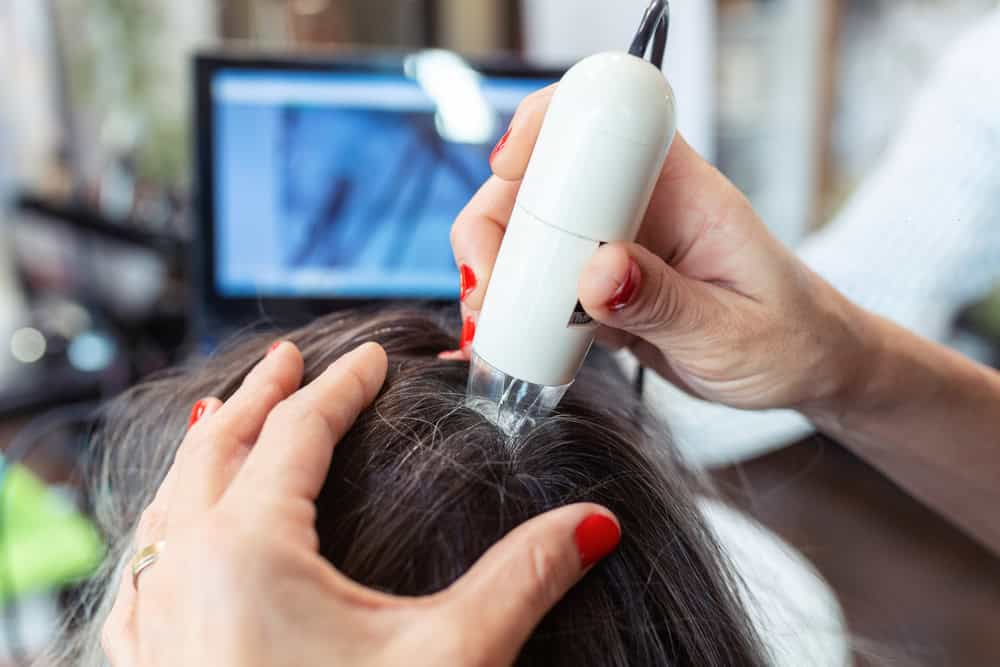 Trichoscopy used to examine the scalp during a consultation for dandruff and hair loss