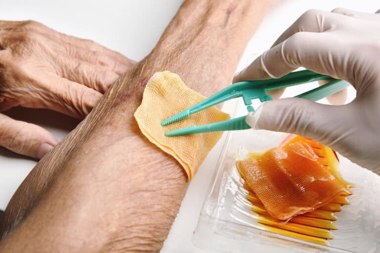 Dressing change on an elderly patient, a key step in shortening chronic wound healing time