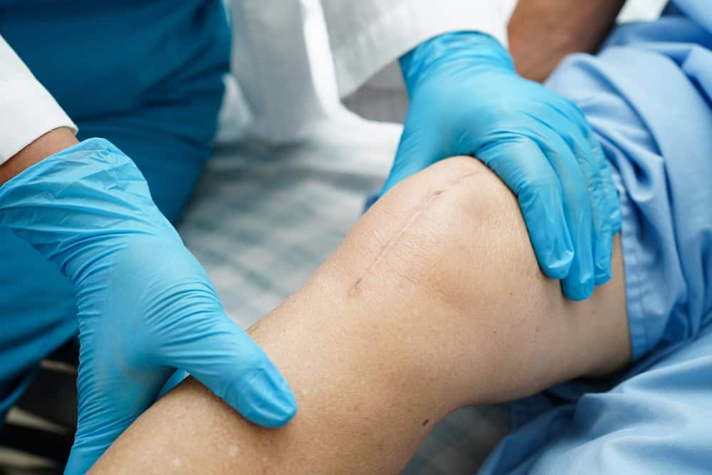 Doctor examining a raised scar to plan how to reduce surgical scars with stem cell therapy