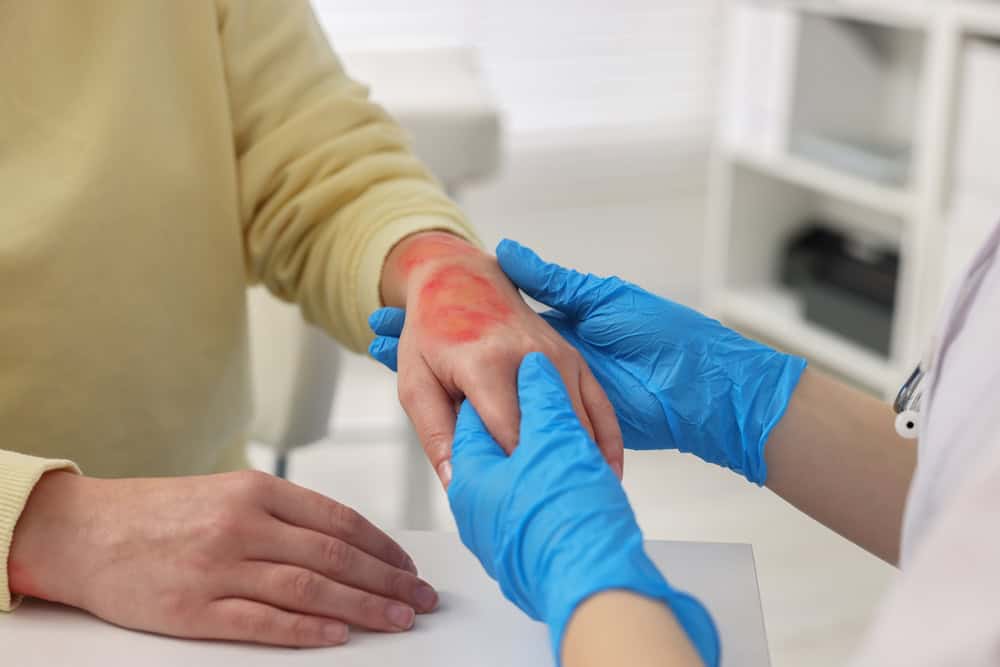 A doctor evaluating a burn on a patient’s hand.