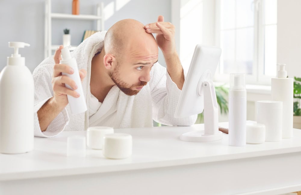 A young man suffering from male pattern hair loss, applying his minoxidil dose for hair loss as part of a treatment plan.