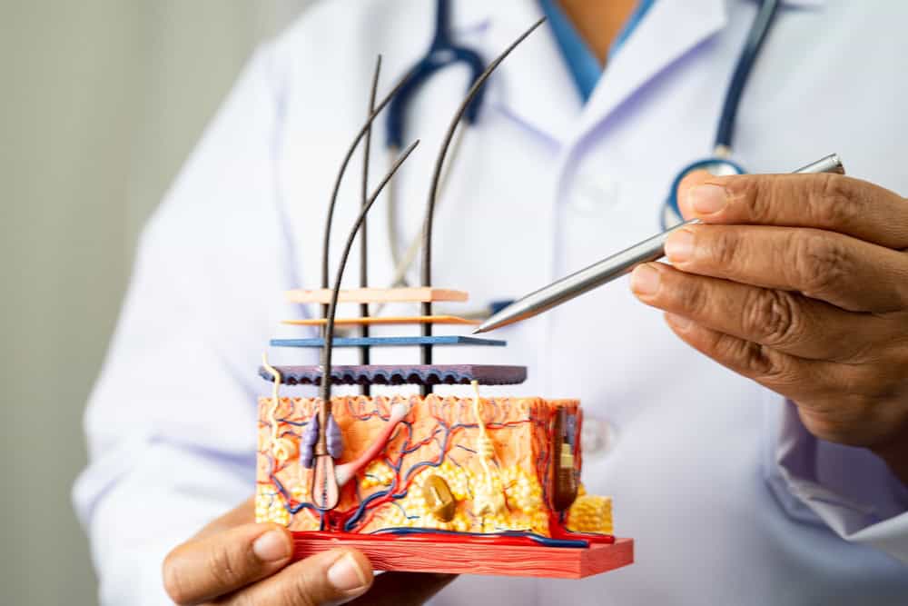 Doctor uses a scalp model to explain how hair transplant follicles look years later