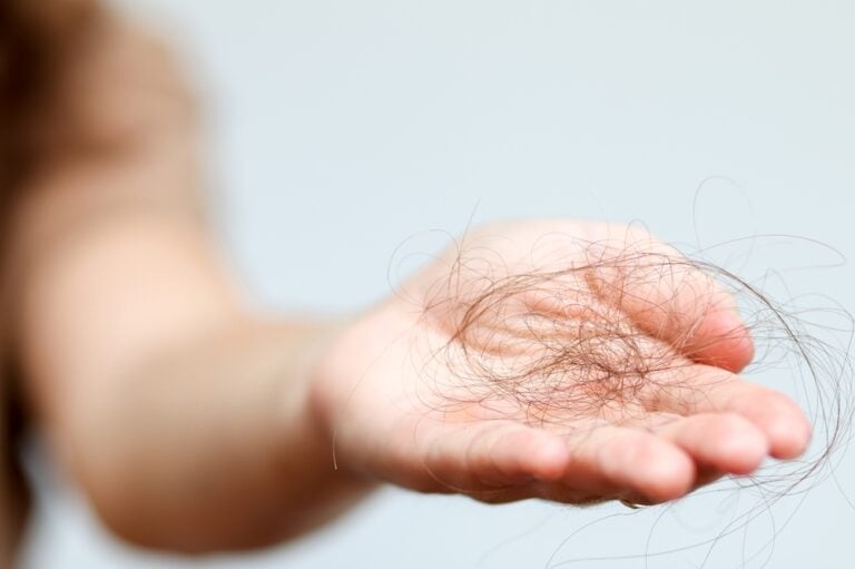 An individual holding a tuft of hair in the palm of their hand before learning to strengthen hair follicles.