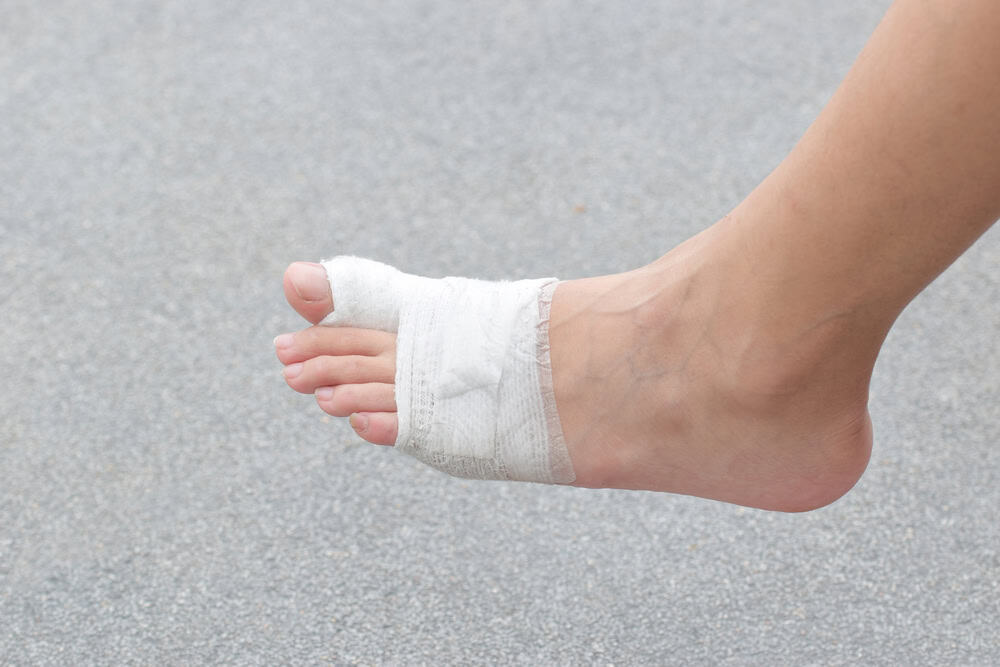 Understand diabetic wound care for safe healing