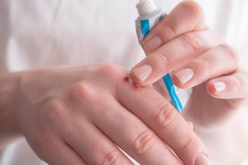An individual rubbing ointment on a healing wound to prevent common signs of an infected wound.