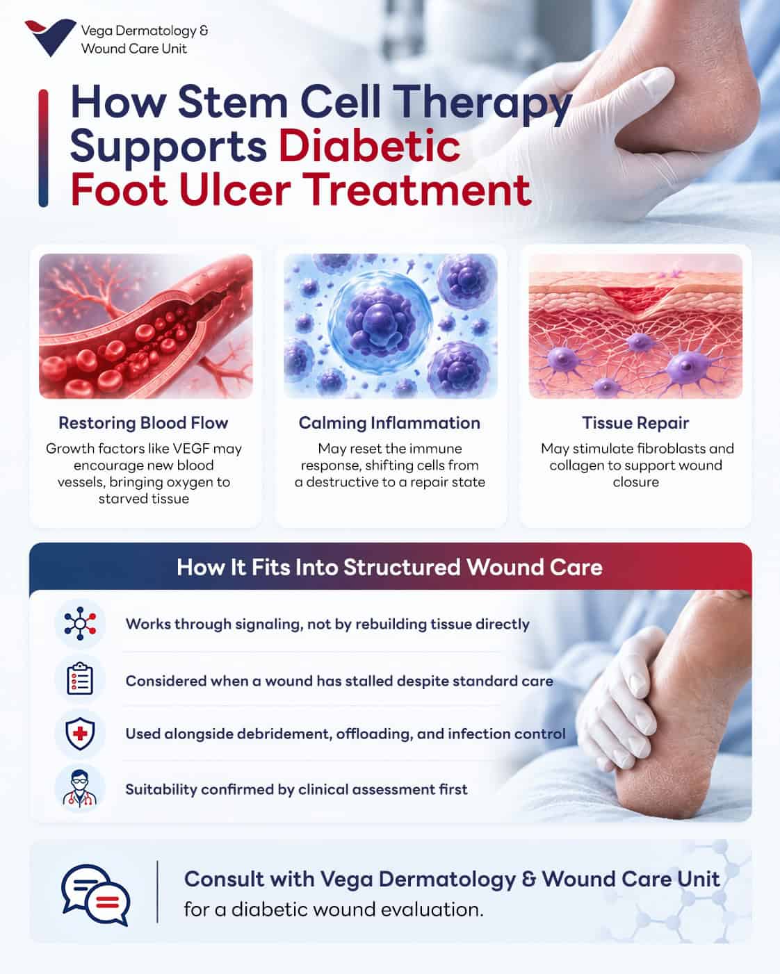 How Stem Cell Therapy Supports Diabetic Foot Ulcer Treatment.