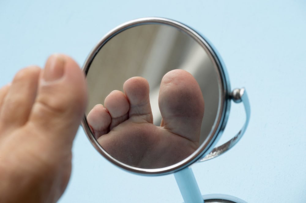 A patient evaluating his foot for diabetic foot ulcers before undergoing stem cell treatment.
