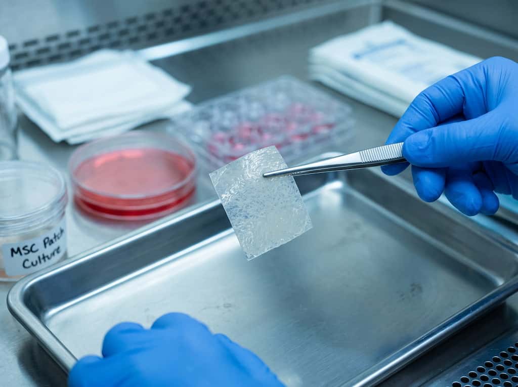 Do stem cell patches work?